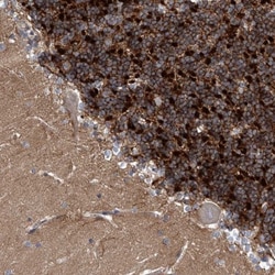 Kv4.2 Antibody, Novus Biologicals:Antibodies:Primary Antibodies